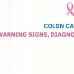 Colon Cancer Symptoms